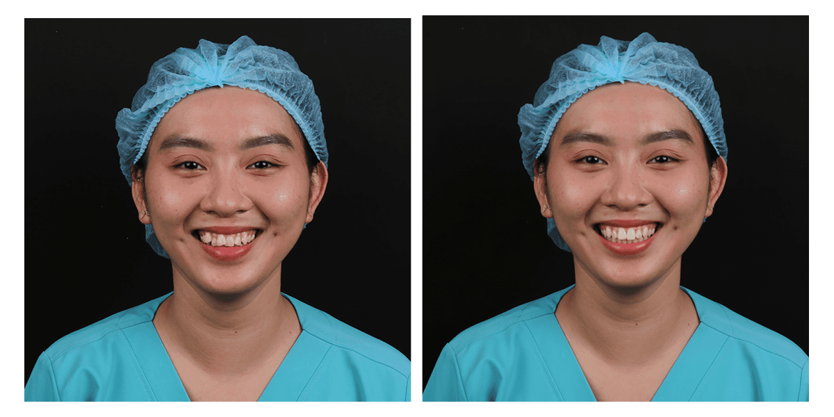 Mô phỏng nụ cười