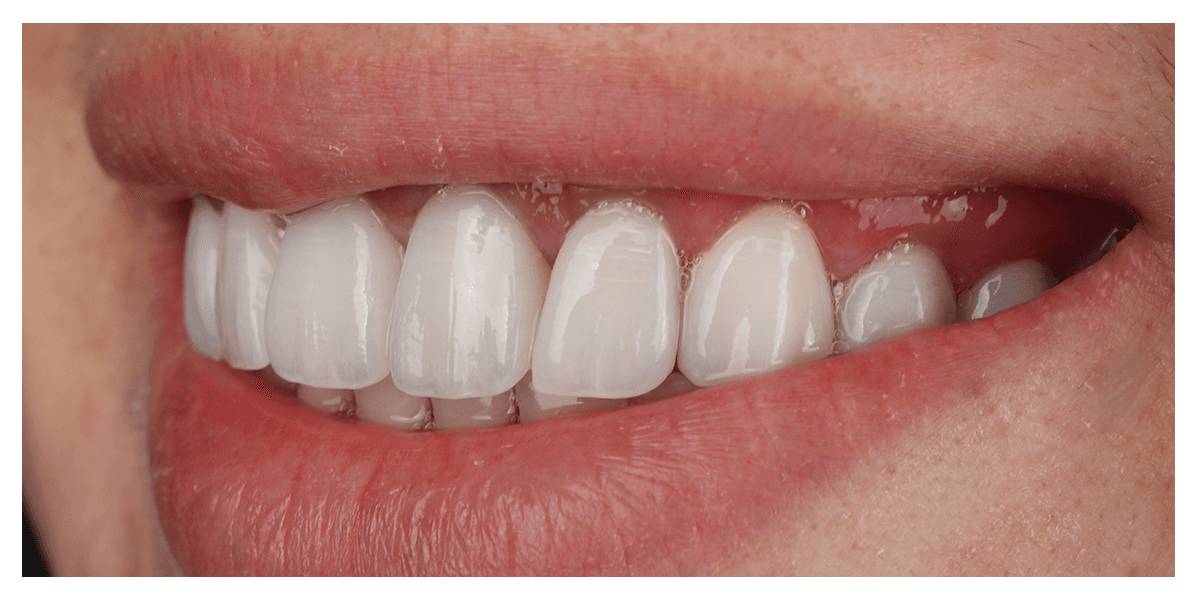 Phân tích nụ cười AI