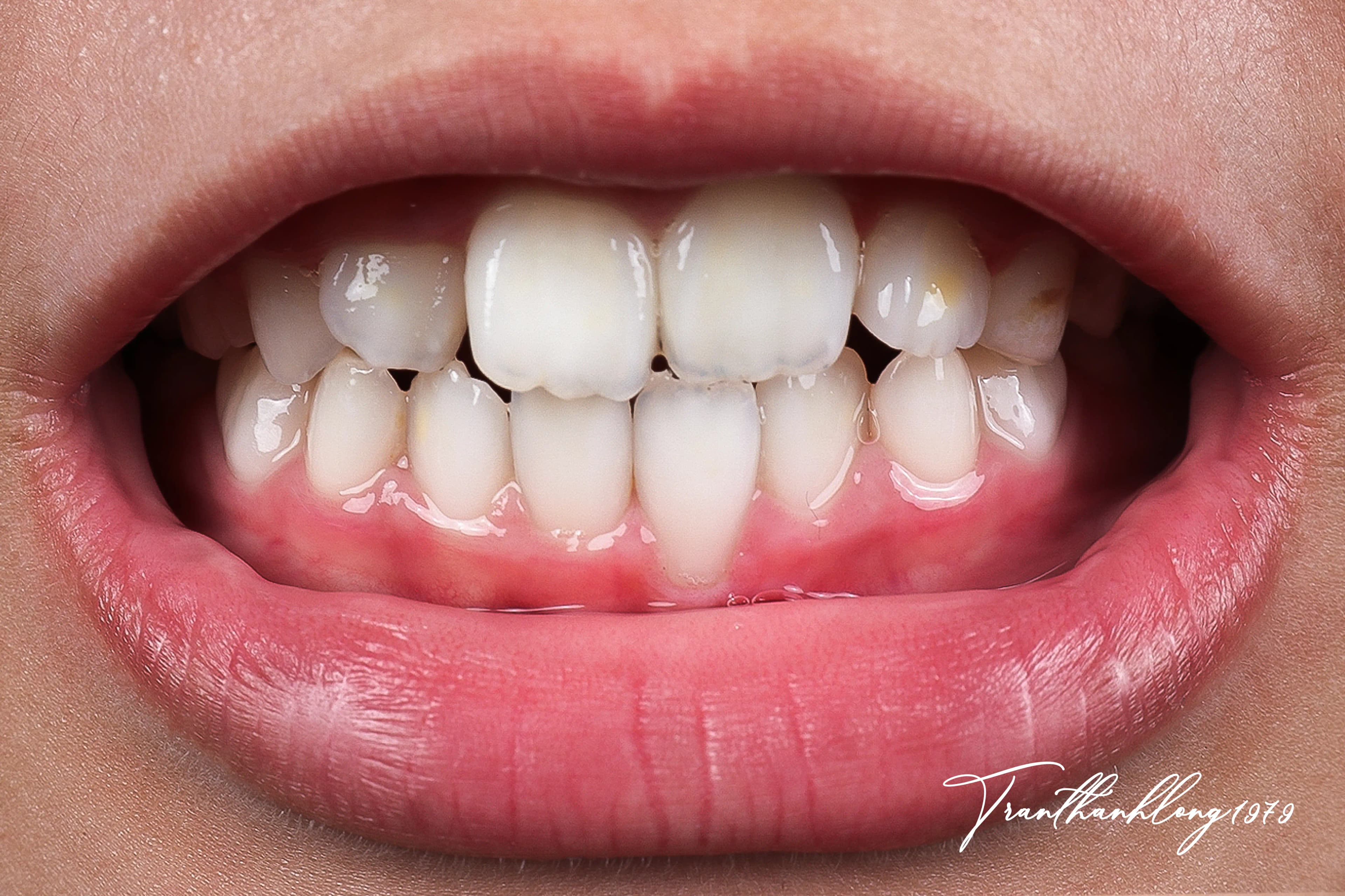 Kết quả điều trị của 002120925 - After