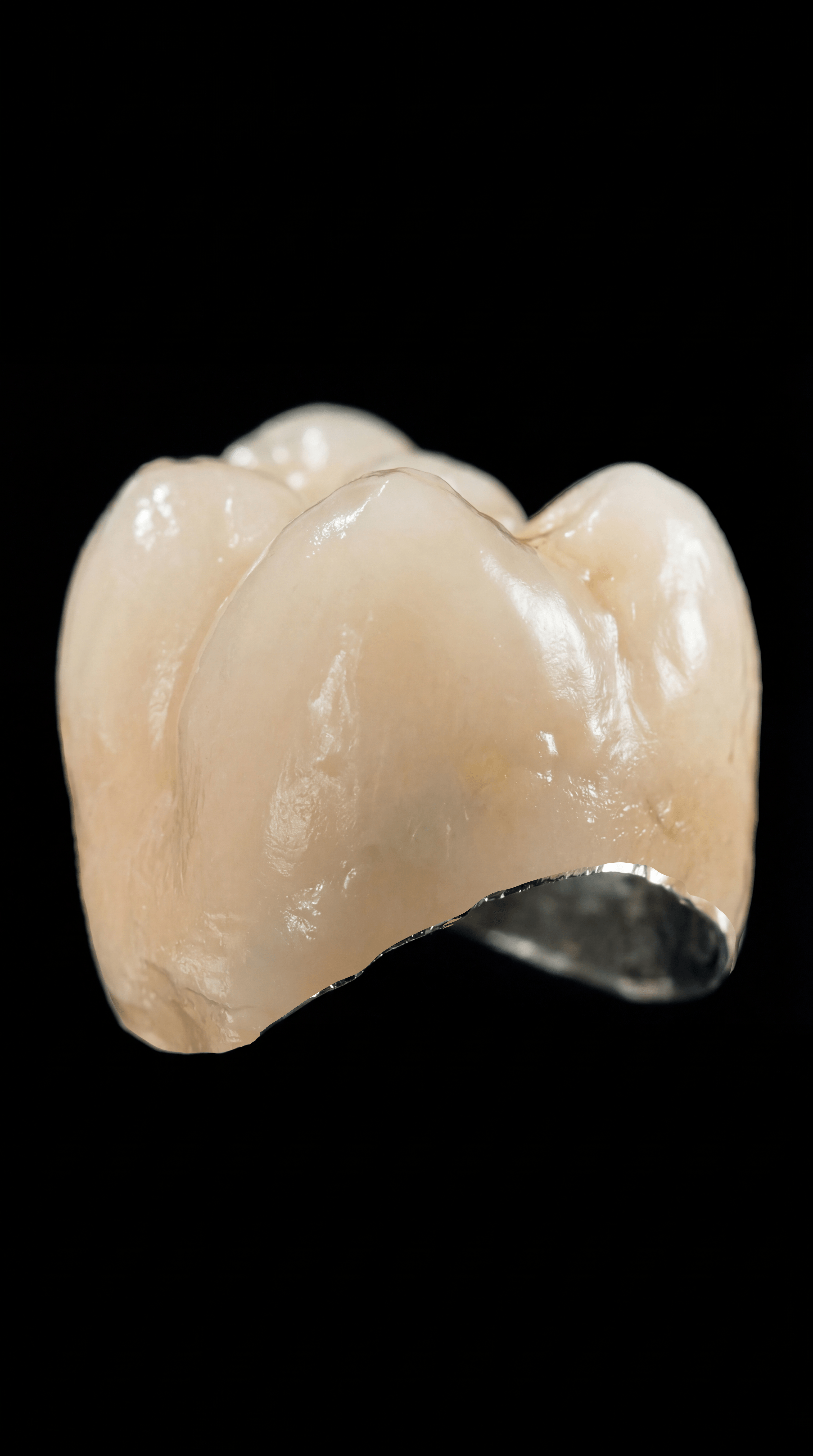 Răng Sứ Kim Loại