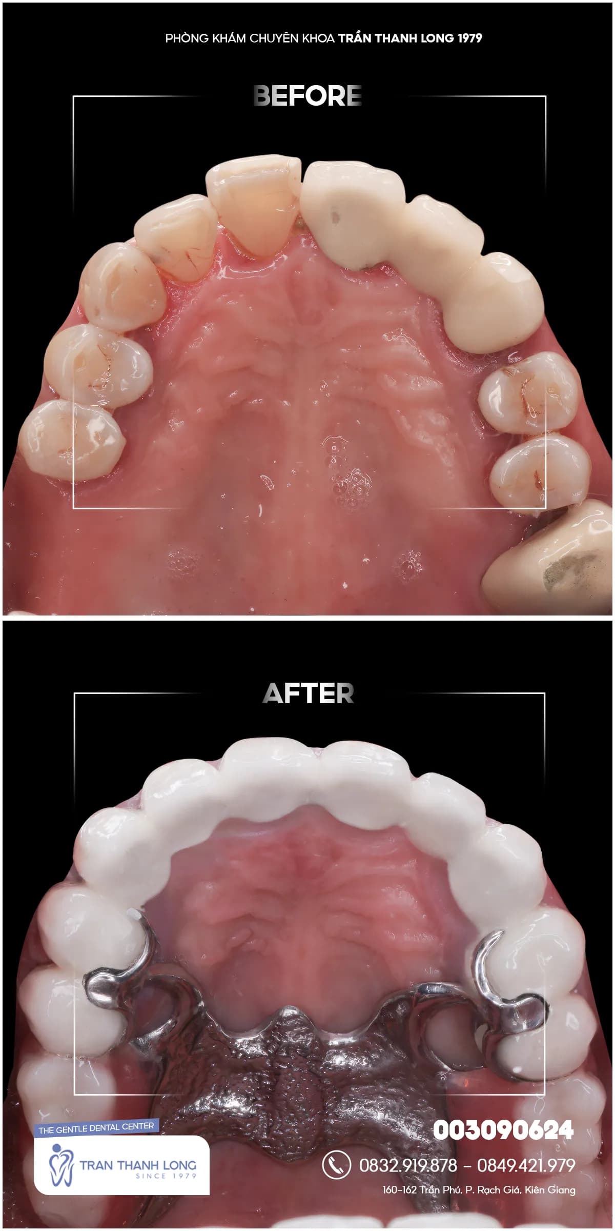 Hình ảnh quá trình điều trị 2