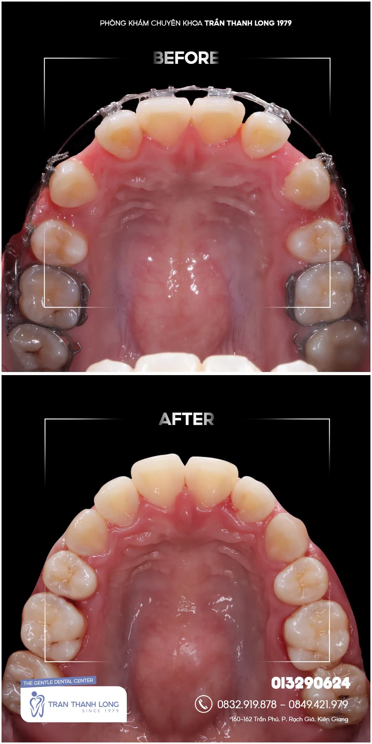 Hình ảnh quá trình điều trị 2