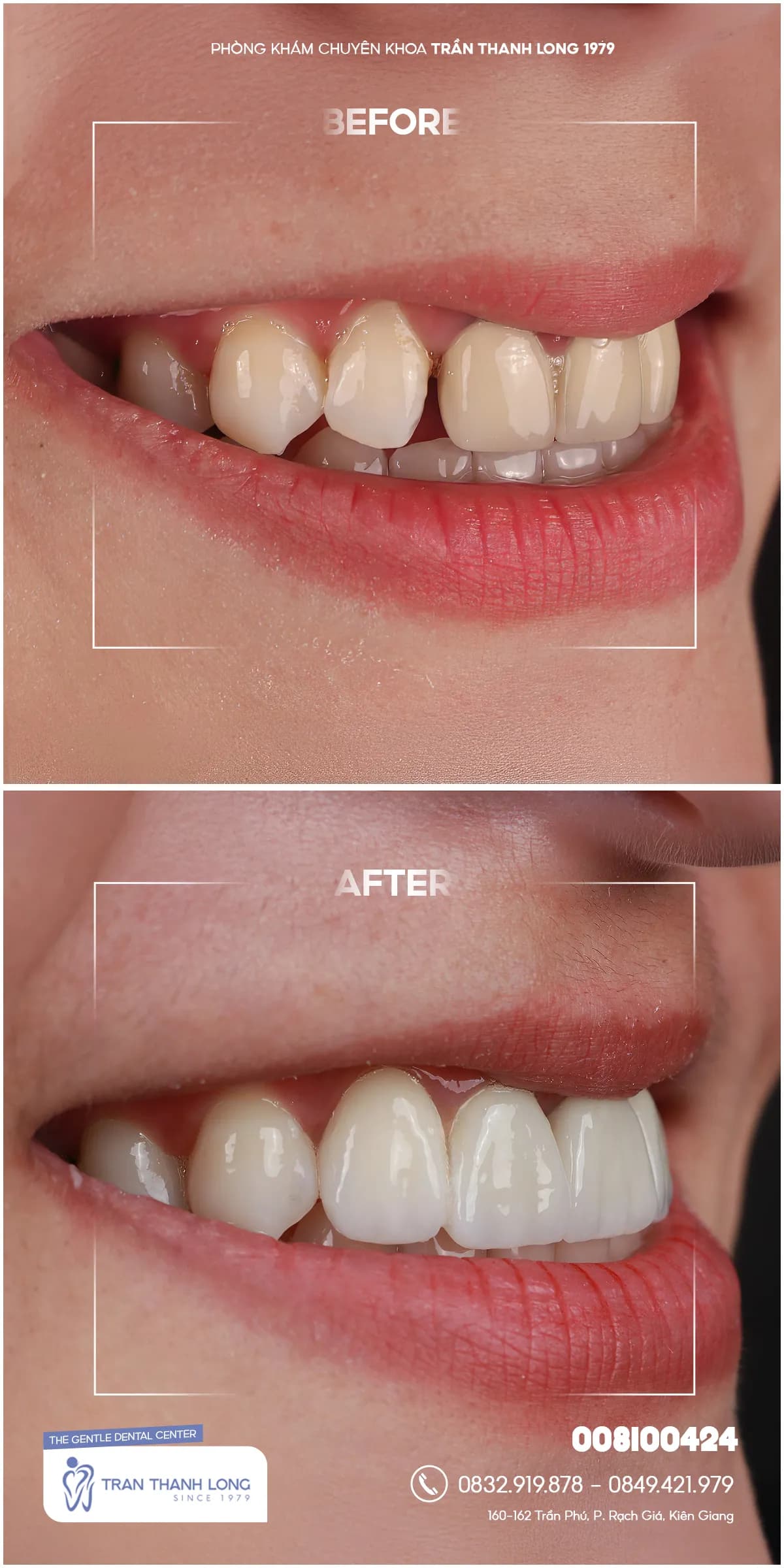 Hình ảnh quá trình điều trị 2