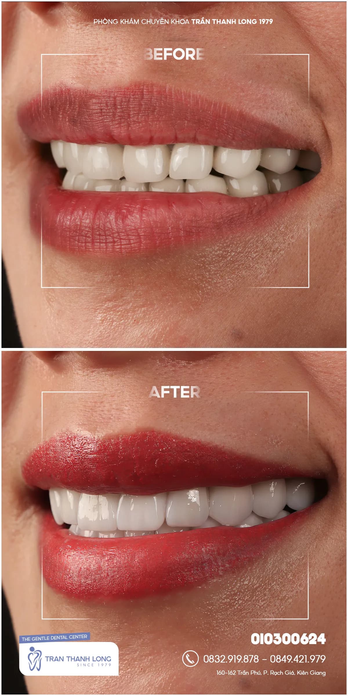 Hình ảnh quá trình điều trị 1