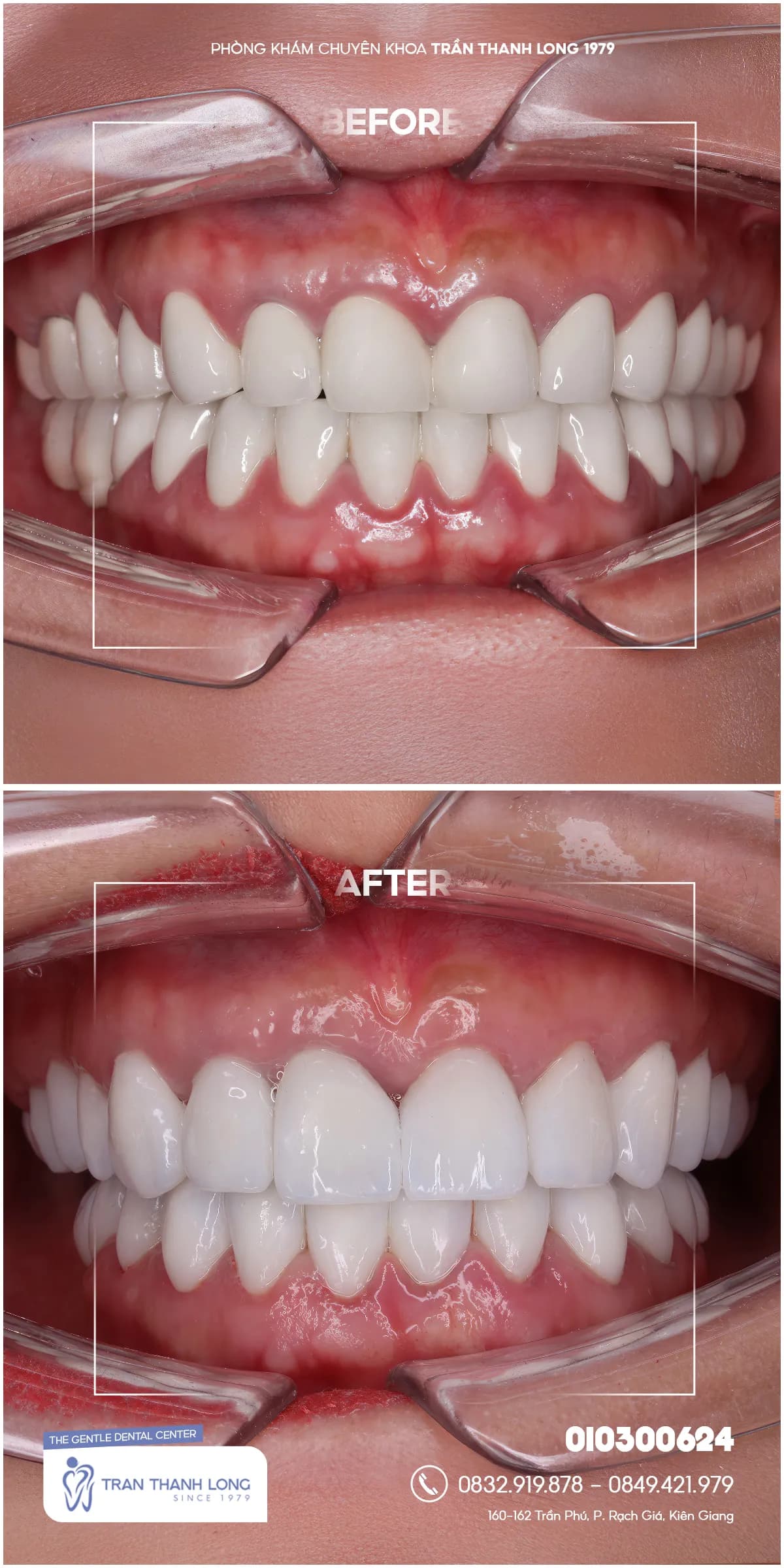 Hình ảnh quá trình điều trị 2